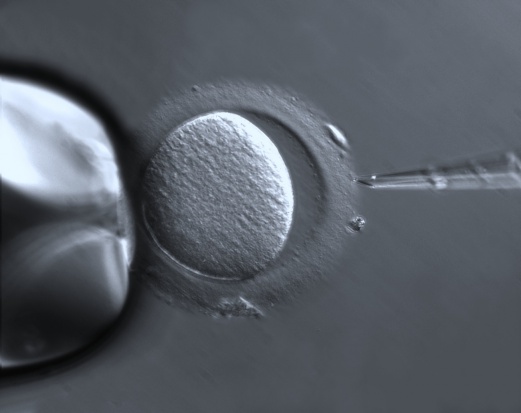 28-latka poprosiła przed śmiercią własną matkę, by wykorzystała jej komórki jajowe i sama urodziła dziecko. Fot. ZEISS Microscopy/Flickr.com (CC BY 2.0) 60-latka chce urodzić własnego wnuka lub wnuczkę