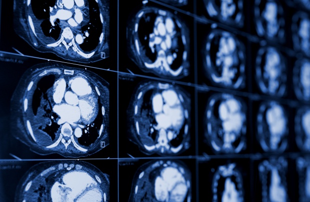 Fot. Shutterstock Późna ciąża zwiększa ryzyko udaru po menopauzie