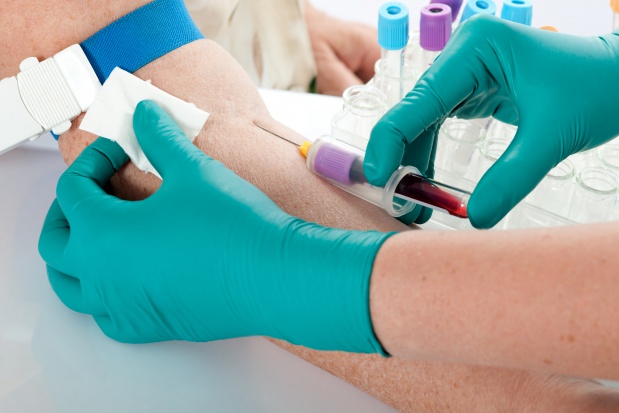 Czy organizm danej osoby starzeje się szybciej czy wolniej ustalimy dzięki badaniu krwi? Fot. Fotolia Wiek biologiczny ustalisz za pomocą badania krwi?