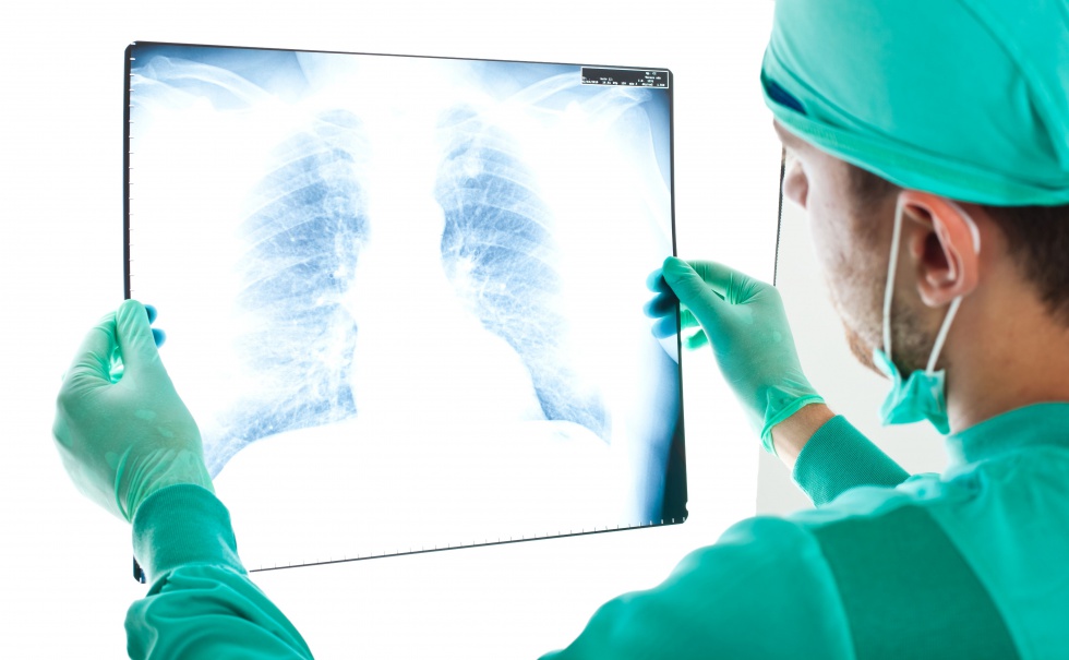 80 proc. chorych na POChP nie ma wykrytego schorzenia. Fot. Fotolia Około 1,6 mln chorych Polaków nie wie, że rozwija się u nich POChP