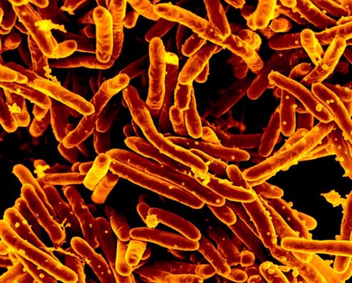 USA: u 76-latka odkryto bakterię z genem odporności na najważniejsze antybiotyki