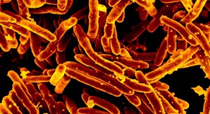 Dramatycznie rośnie liczba szczepów bakterii odpornych na antybiotyki