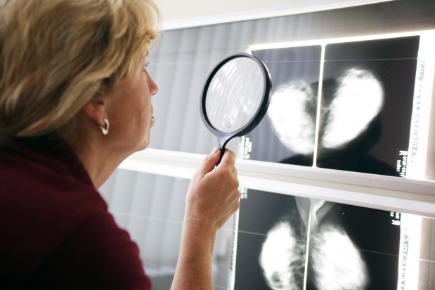 Ryzyko samobójstwa jest najwyższe w pierwszych sześciu miesiącach po diagnozie stwierdzającej nowotwór. Fot. Fotolia Diagnoza potwierdzająca nowotwór zwiększa ryzyko samobójstwa